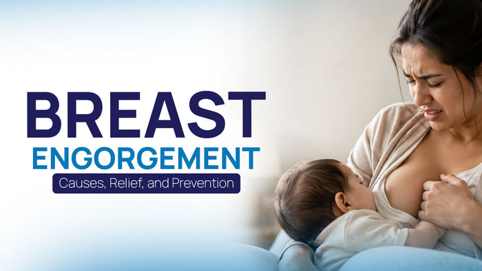 Breast Engorgement: Causes, Relief, and Prevention